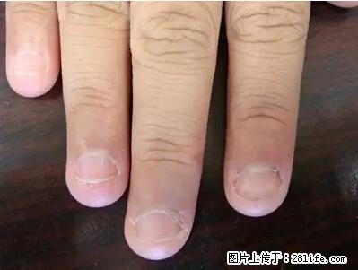 剪指甲、挖耳屎，这些日常小动作竟隐藏大危害！ - 昆明生活资讯 - 昆明28生活网 km.28life.net